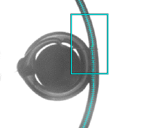 CognexEdgeInspect.BeadInspect.RectangleCalipers