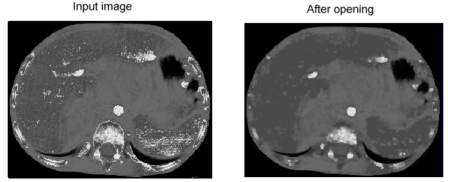 Image Processing Morphology Theory Grey Scale Morphology Opening