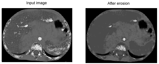Image Processing Morphology Theory Grey Scale Morphology Example Erosion