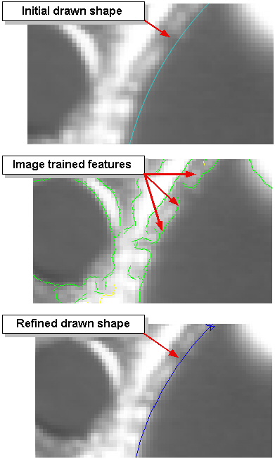 Search PMAlign Walkthrough Draw Patterns htdtp imagetraining