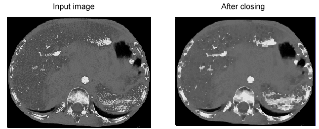 Image Processing Morphology Theory Grey Scale Morphology Closing