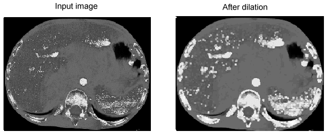 Image Processing Morphology Theory Grey Scale Morphology Example Dilation